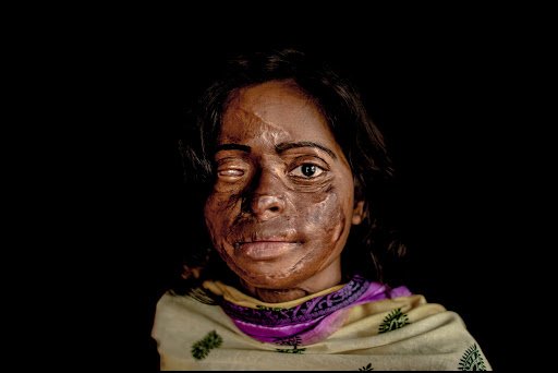 तेजाब हान्नेलाई कडा कानुन : कुन अवस्थामा कति सजाय?