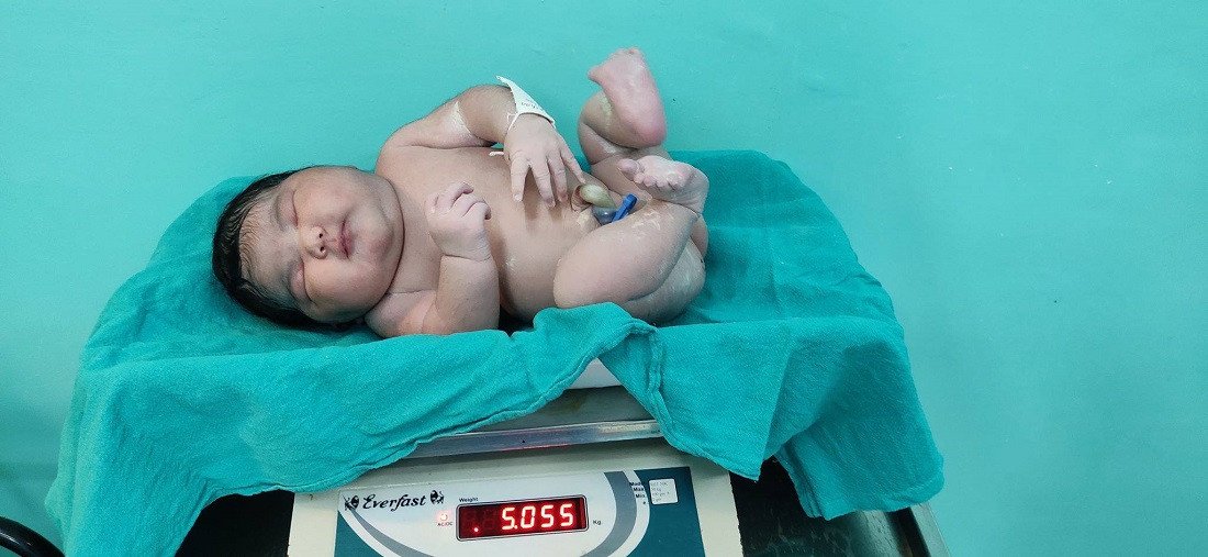 चितवन मेडिकल कलेजमा जन्मियो ५ केजीको बच्चा