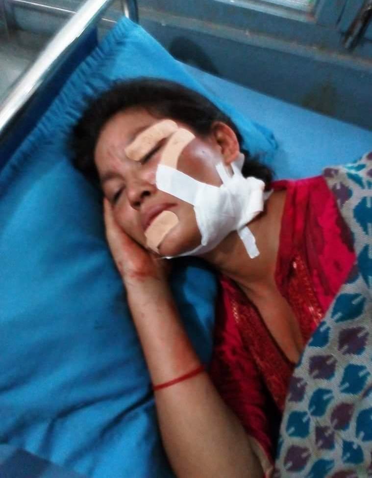 व्यस्त सडकमै हाने श्रीमानले चक्कु