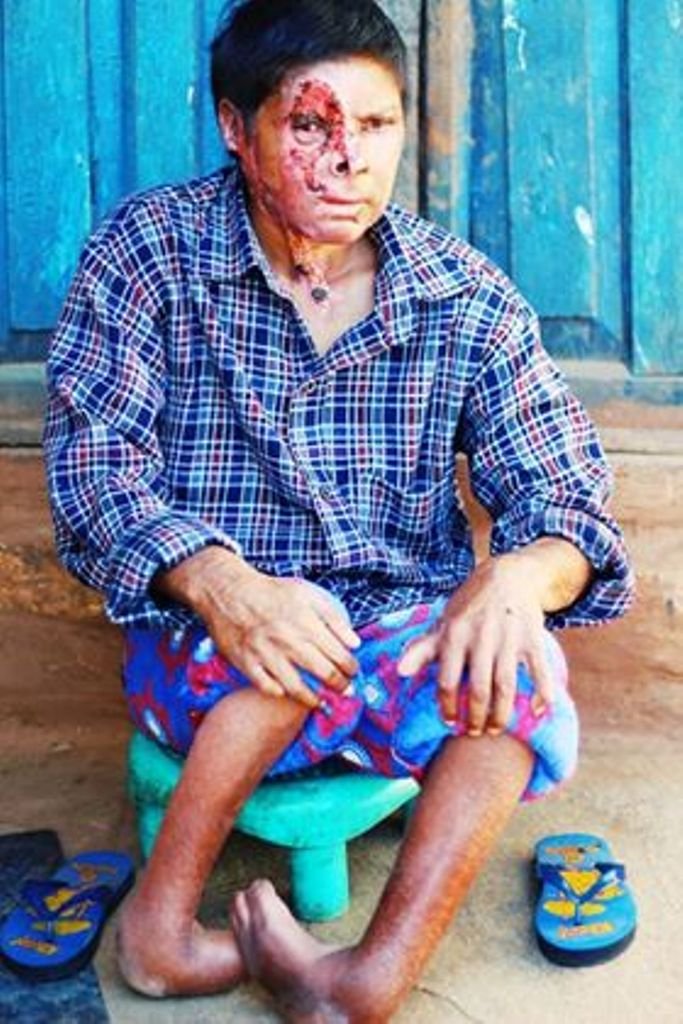 पीडाको दलदलमा हिरा, सहयोगको अपिल