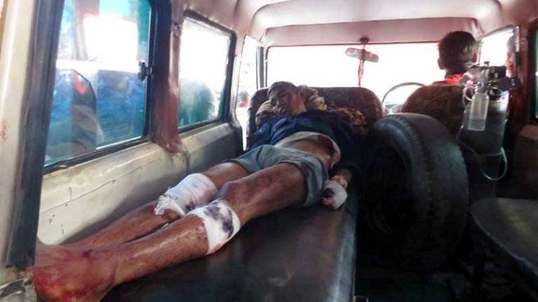 तुलसीपुरको बम बिष्फोटमा घाईते म्यादी प्रहरीको मृत्यु 