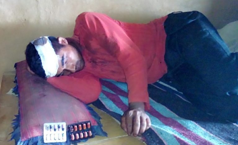 वडा कार्यालय सार्ने विषयमा झडप, दुई गम्भिर घाइते